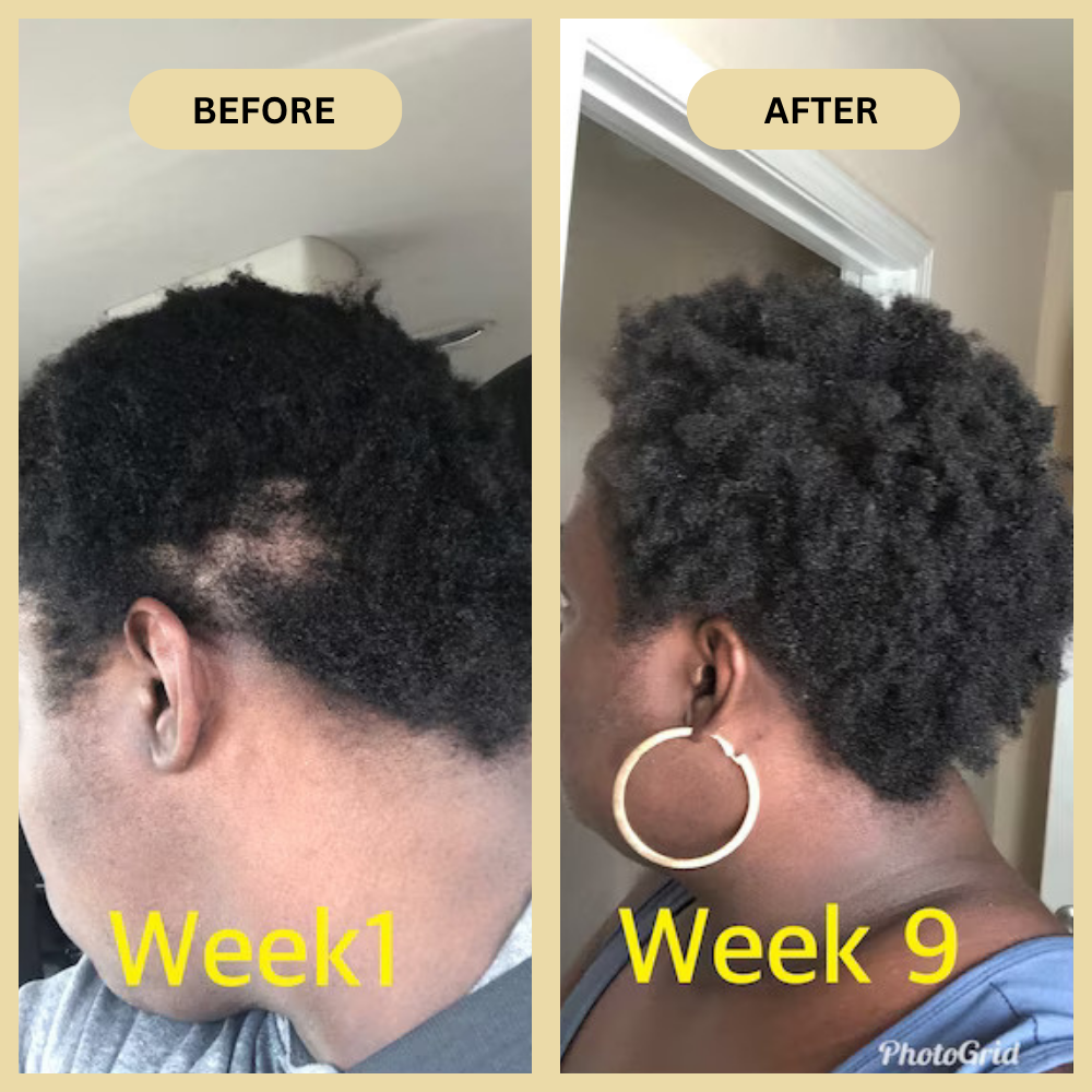 Early Black Friday Sale - Veganic Natural Hair Growth Oil