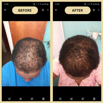 Early Black Friday Sale - Veganic Natural Hair Growth Oil