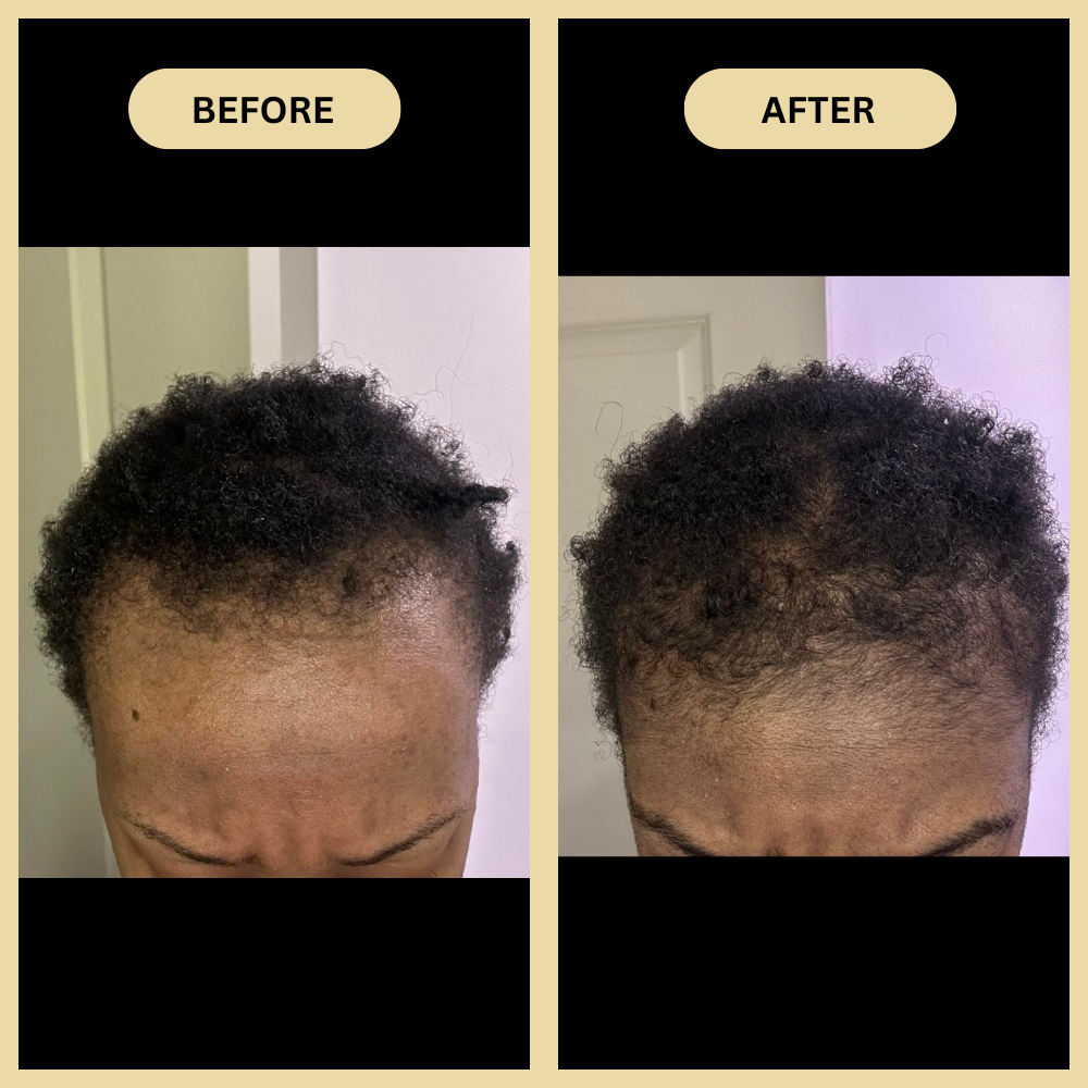 Early Black Friday Sale - Veganic Natural Hair Growth Oil