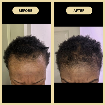 Early Black Friday Sale - Veganic Natural Hair Growth Oil