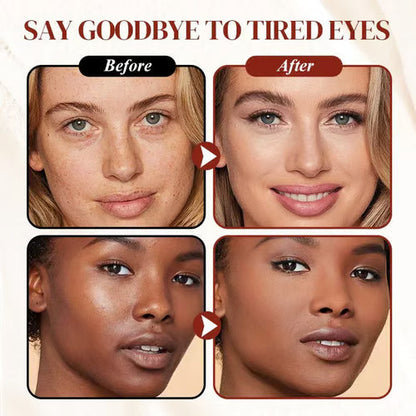 🎁 Holiday Glow: Get Brighter, Smoother Eyes — Buy 1 Get 1 Free