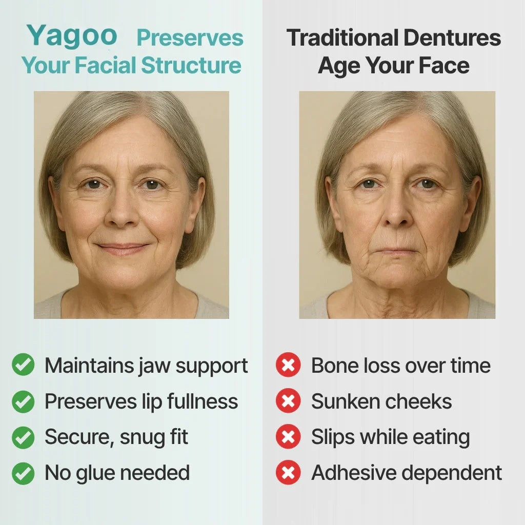 🌎Ends Today: 70% OFF! ⏰Yagoo™ Medical Full Denture with Strong Suctiond